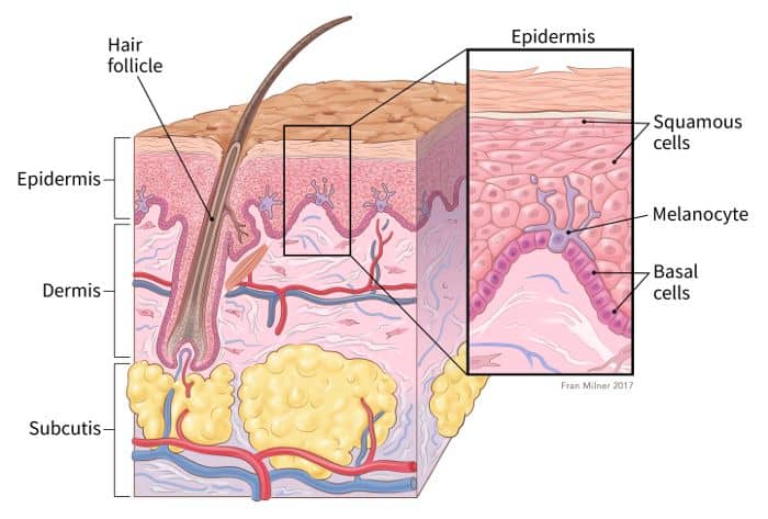 About Melanoma